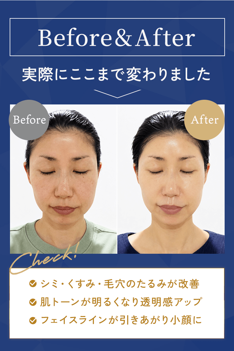 ビフォーアフター